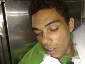 Políciais Militares ficam feridos após troca de tiros em Maceió