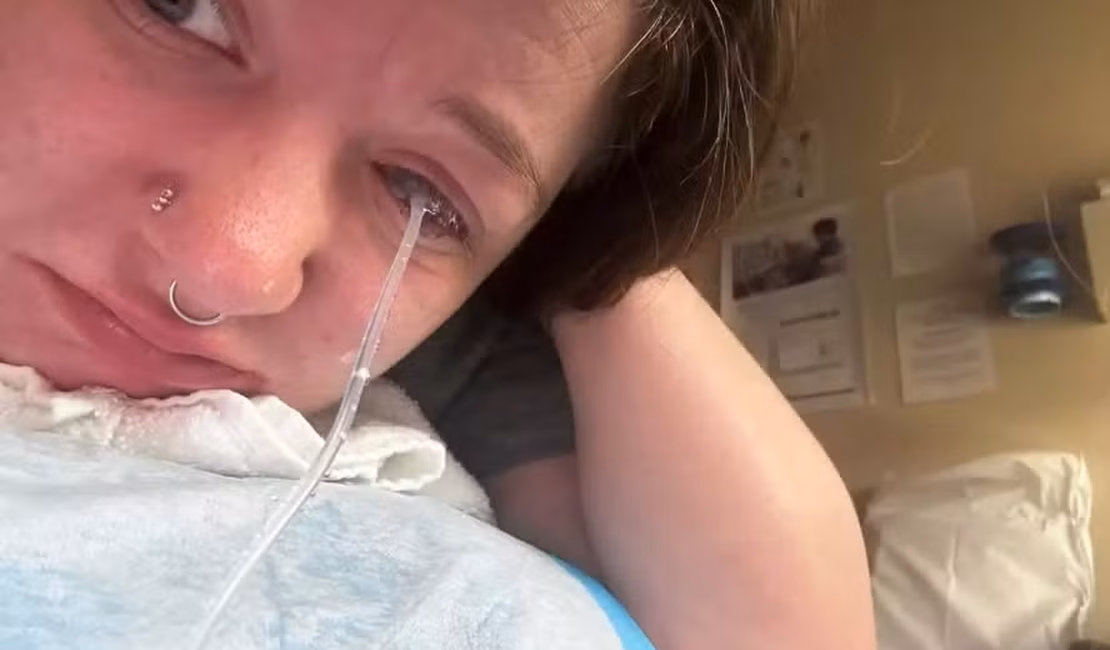 Mulher lava roupas antes de dormir e acorda com sequela permanente num olho