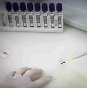 Paciente em SP com suspeita de ebola testa positivo para meningite