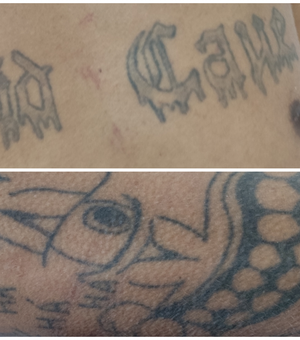 Hospital de Emergência do Agreste procura familiares de paciente identificado apenas como Rafael