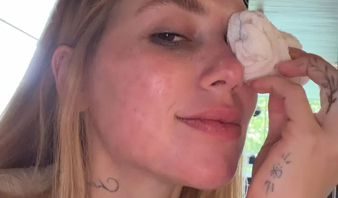 Virginia surge com lesão no olho após acidente envolvendo a filha