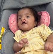 Família faz rifa para custear cirurgias de bebê nascida com malformações