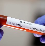 Coronavírus: laboratório britânico dará R$ 20 mil para quem testar vacina