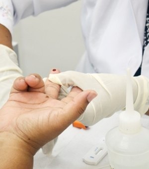 Hospital Helvio Auto oferece testes rápidos para detectar HIV