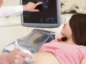 Sesau ajusta plano de ação para casos suspeitos de Zika e microcefalia