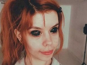 Mulher de 25 anos fica cega após tentar tatuar os olhos de preto