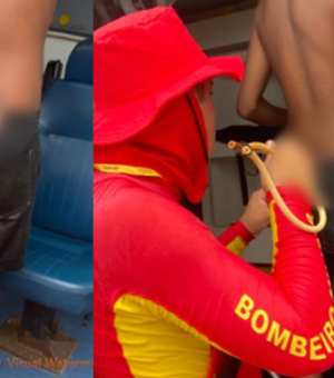 Adolescente de 14 anos é atingido por arpão durante pesca na praia do Francês