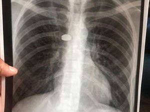 PM é afastado após atirar a esmo na zona leste de SP 