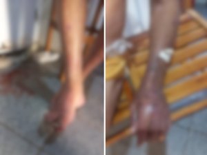 Idoso de 84 anos é encontrado ensanguentado e coberto por hematomas em Belo Monte; Filha é presa