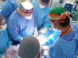 Gêmeas siamesas têm nova cirurgia para separação de crânio em SP