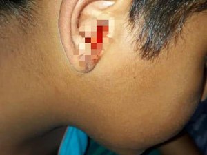 Família pede ajuda para tratamento de criança com doença no ouvido em Arapiraca 