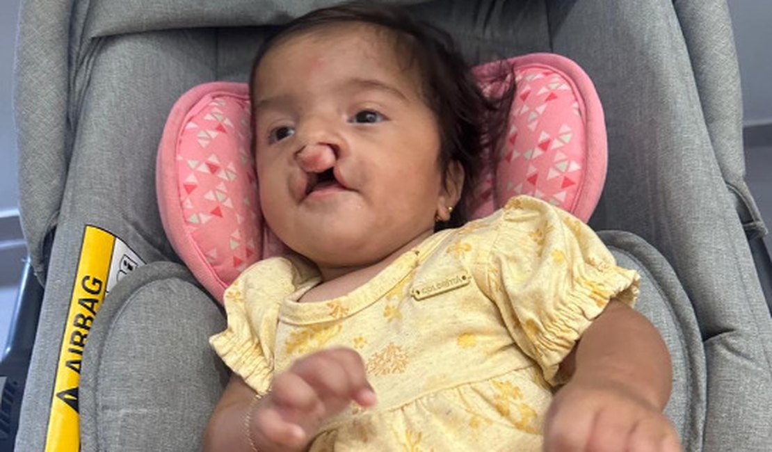 Família faz rifa para custear cirurgias de bebê nascida com malformações