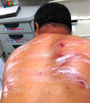 Radialista alagoano é agredido por  homens armados na porta de casa em Pernambuco