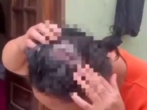 Mulher que levou 20 pontos na cabeça após ser atacada por ex relata histórico violento do agressor