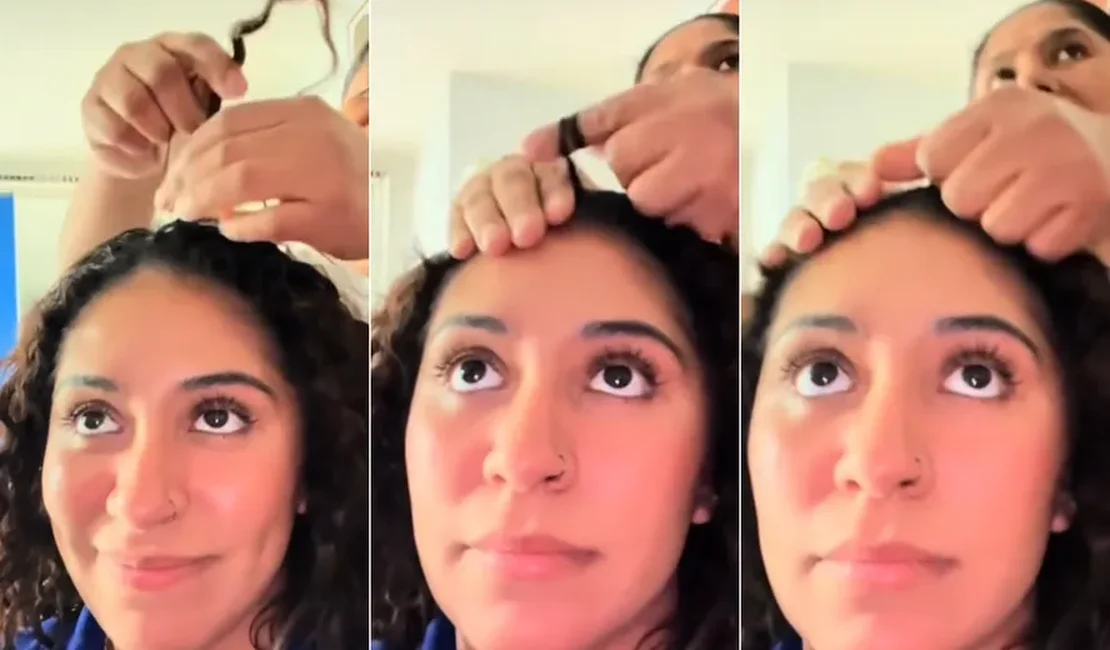 Hair Popping: técnica de puxar o cabelo para acabar com a dor de cabeça viraliza no Tik Tok, médica aponta os riscos