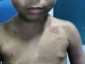 Mulher é presa em flagrante suspeita de espancar a filha