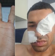 Homem sobrevive a tentativa de homicídio após ser baleado na AL-115, em Arapiraca