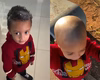 Criança usa creme depilatório na cabeça e perde o cabelo