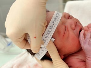 Cievs/AL descarta 79 casos suspeitos de microcefalia