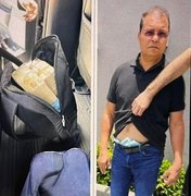 Justiça concede liberdade a marido de deputada federal flagrado com dinheiro na cueca