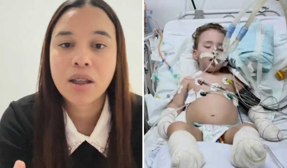 Mãe diz que pai roubou vaquinha feita pra bebê que teve membros amputados em AL