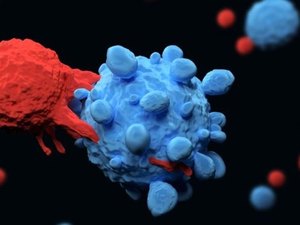 Cientistas encontram relação entre anemia e aumento no risco de demência