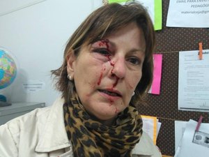 Professora é agredida com socos após repreender aluno 