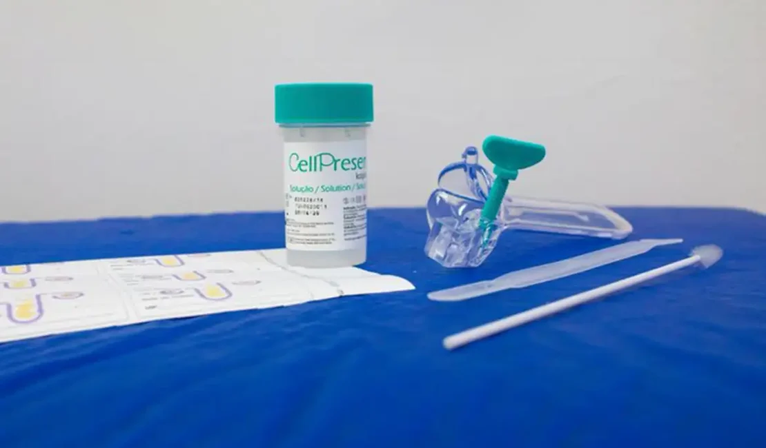 Guia orienta sobre mudança no rastreamento do câncer de colo do útero