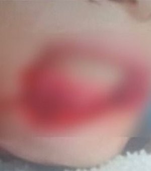 Polícia apura agressão brutal contra jovem que teve lábios arrancados pelo companheiro em Viçosa