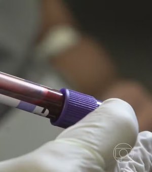 Licitação de laboratório envolvido em infecção por HIV será investigada