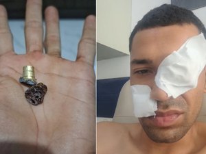 Homem sobrevive a tentativa de homicídio após ser baleado na AL-115, em Arapiraca