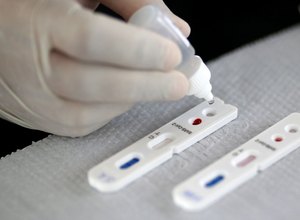 Vacina da Fiocruz contra covid-19 entra na fase de testes em animais 