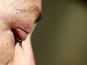 Organizadora de grupo contra Bolsonaro é agredida no Rio