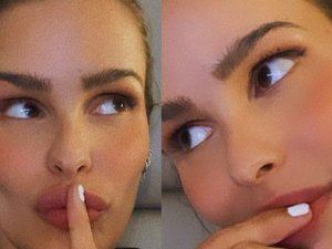 Aos 33, Yasmin Brunet revela uso de Botox 'para ficar com 20 anos'