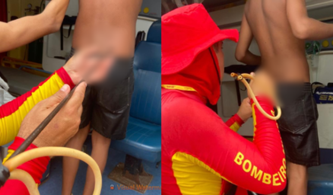 Adolescente de 14 anos é atingido por arpão durante pesca na praia do Francês