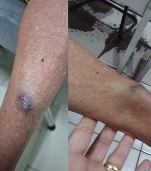 Médica é denunciada pelo MPAL por agredir tia idosa de 77 anos em Arapiraca