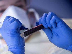 Covid-19: médicos dizem acreditar em subnotificação em casos e mortes