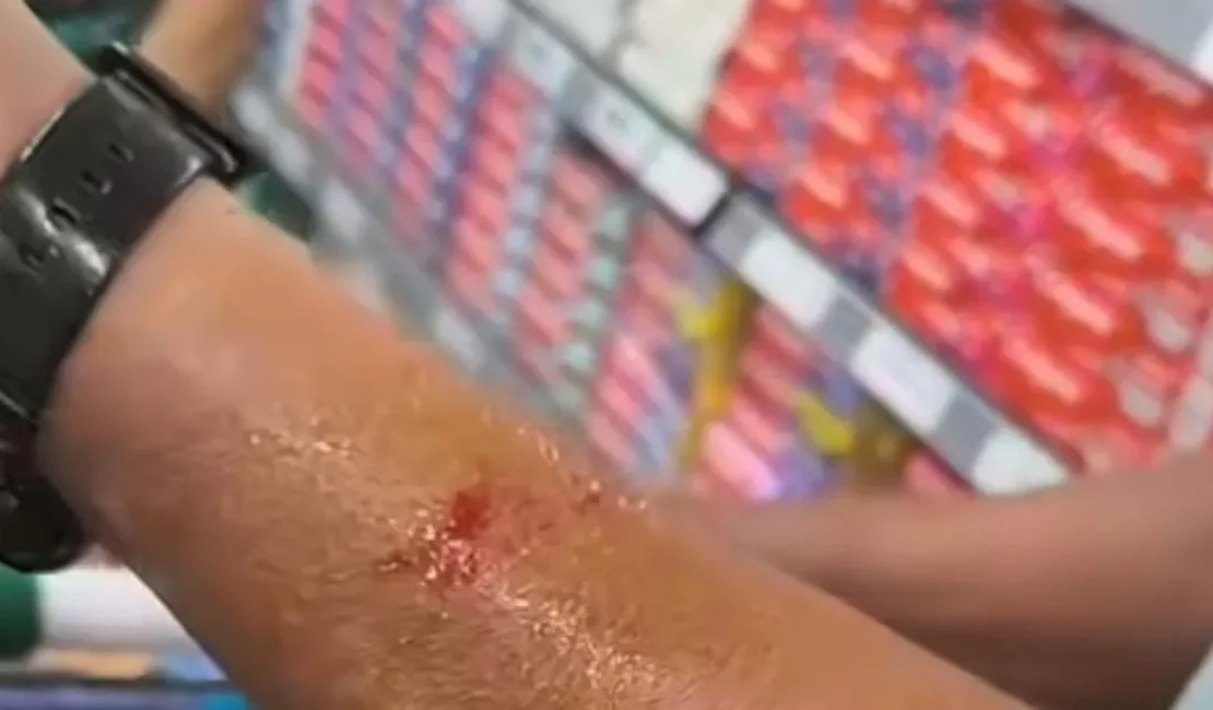 Ninho de ratos cai sobre cliente em supermercado de Niterói