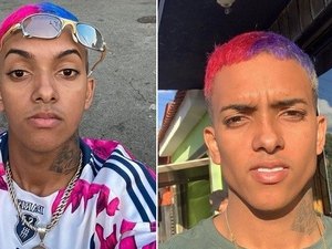 MC Brinquedo faz harmonização facial, recebe críticas e deixa as redes sociais
