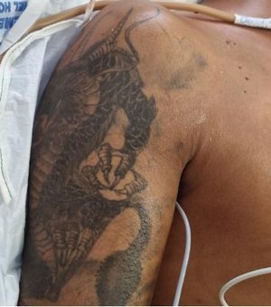 Hospital de Emergência do Agreste procura por familiares de paciente não identificado