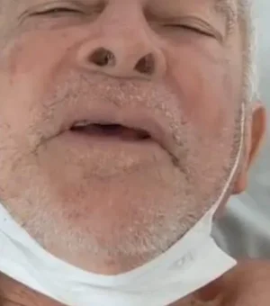 Idoso atropelado em Maragogi aguarda cirurgia após material hospitalar acabar, diz família