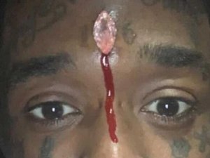 Rapper diz que pode morrer se não tirar diamante da testa corretamente