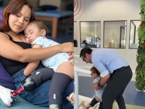 Após desvio de R$ 113 mil pelo pai, bebê amputado de Murici começa a andar com próteses