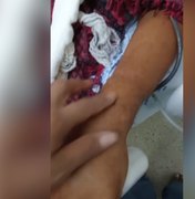 Família de paciente custodiado relata suposta negligência em atendimento no HEA, em Arapiraca