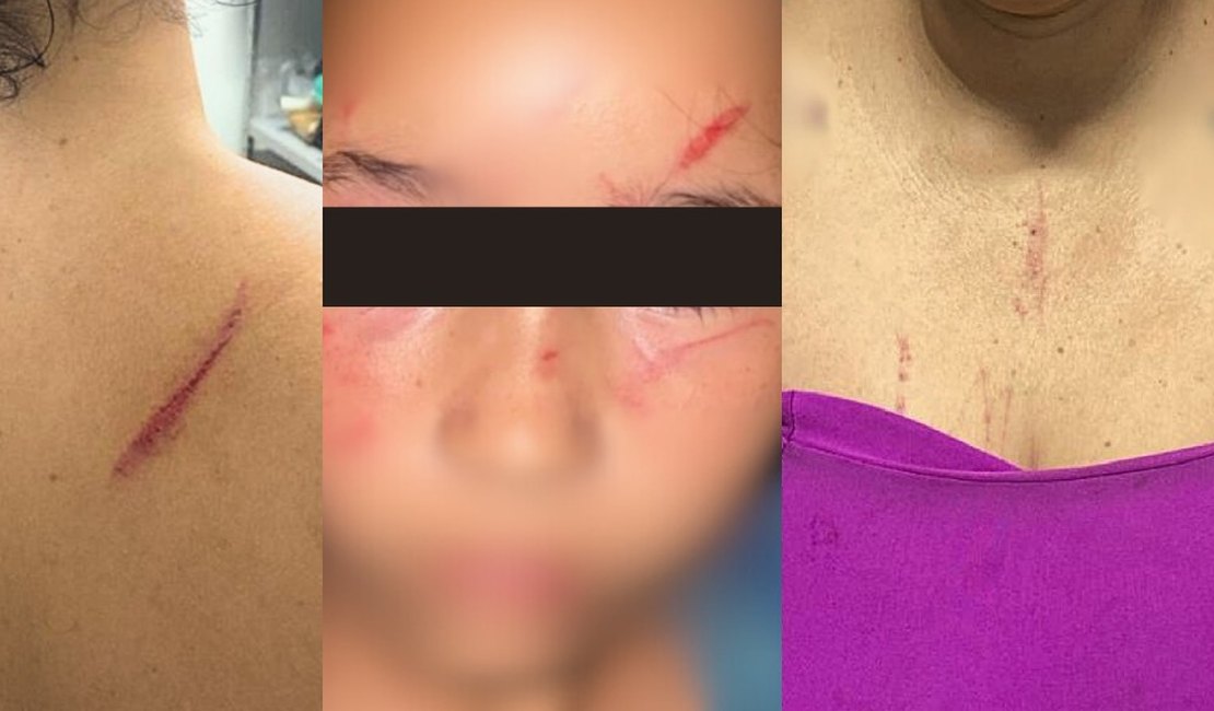 Justiça converte em preventiva prisão de homem que agrediu filha de 8 anos e ex-companheira em Arapiraca