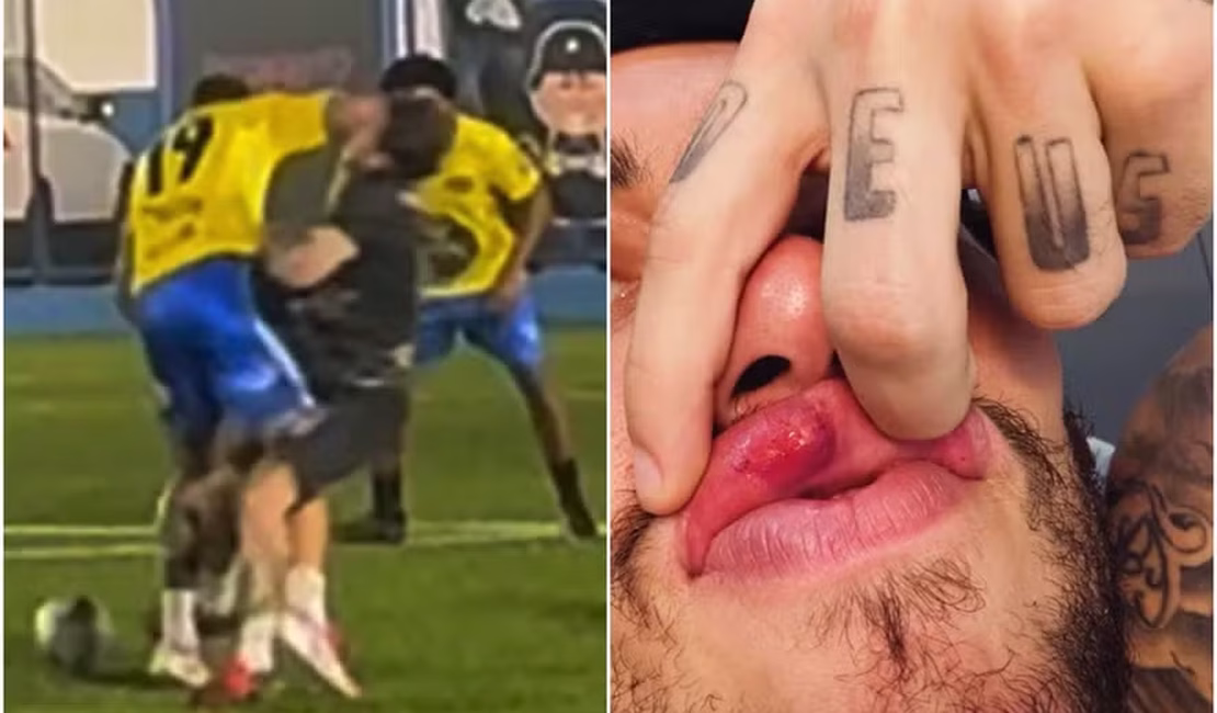 MC Daniel desabafa após levar cotovelada em jogo beneficente: 'Bater pra machucar'