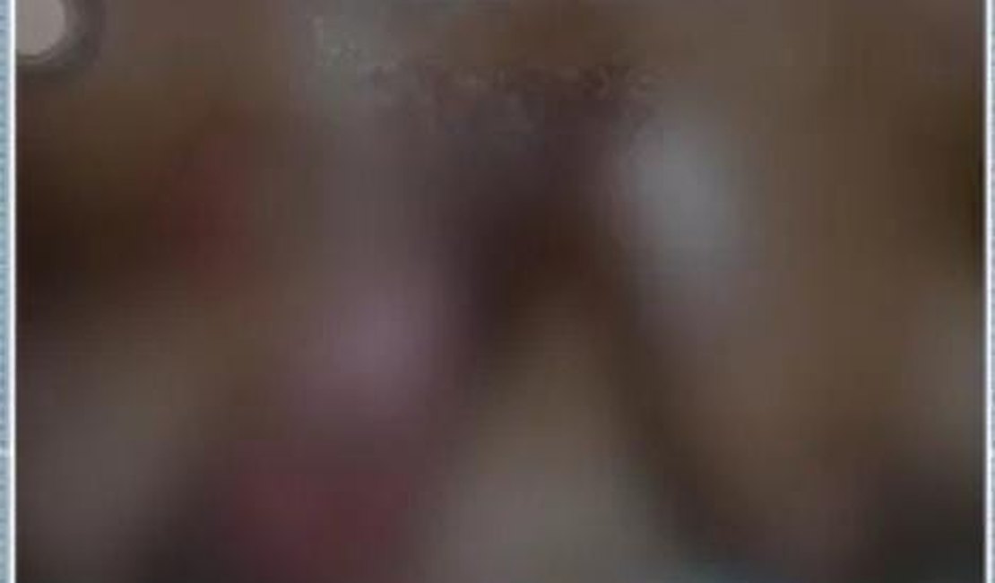 Mulher tem seios queimados com óleo quente pelo marido no Sertão de Alagoas; suspeito fugiu