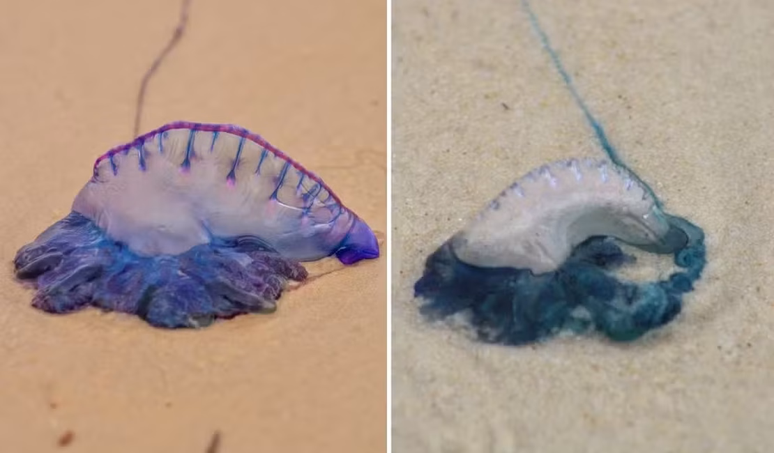 Jovem sofre queimaduras de caravelas no rosto, na Praia do Francês