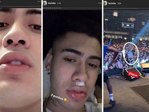 Após ser atingido no rosto por placa de PVC, MC Kevinho é levado para o hospital