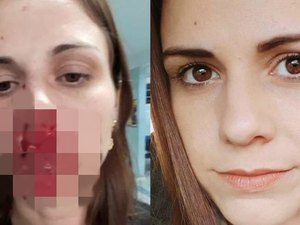 Mulher acusa ex-marido de agressão e posta foto com rosto ensanguentado